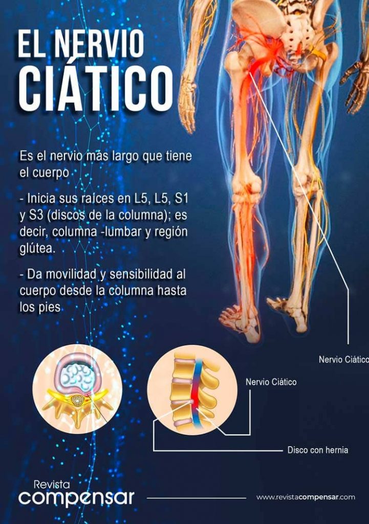 ejercicios-para-ciatica-lumbago-sintomas-tratamientos-diagnosticos