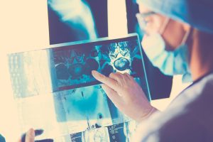 doctor revisando radiografía de uno de los tipos de cáncer más comunes