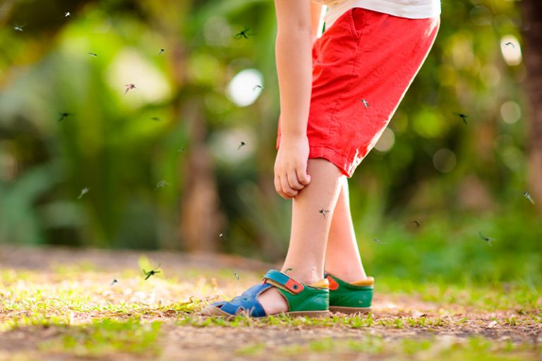 niño se rasca una picadura de un mosquito